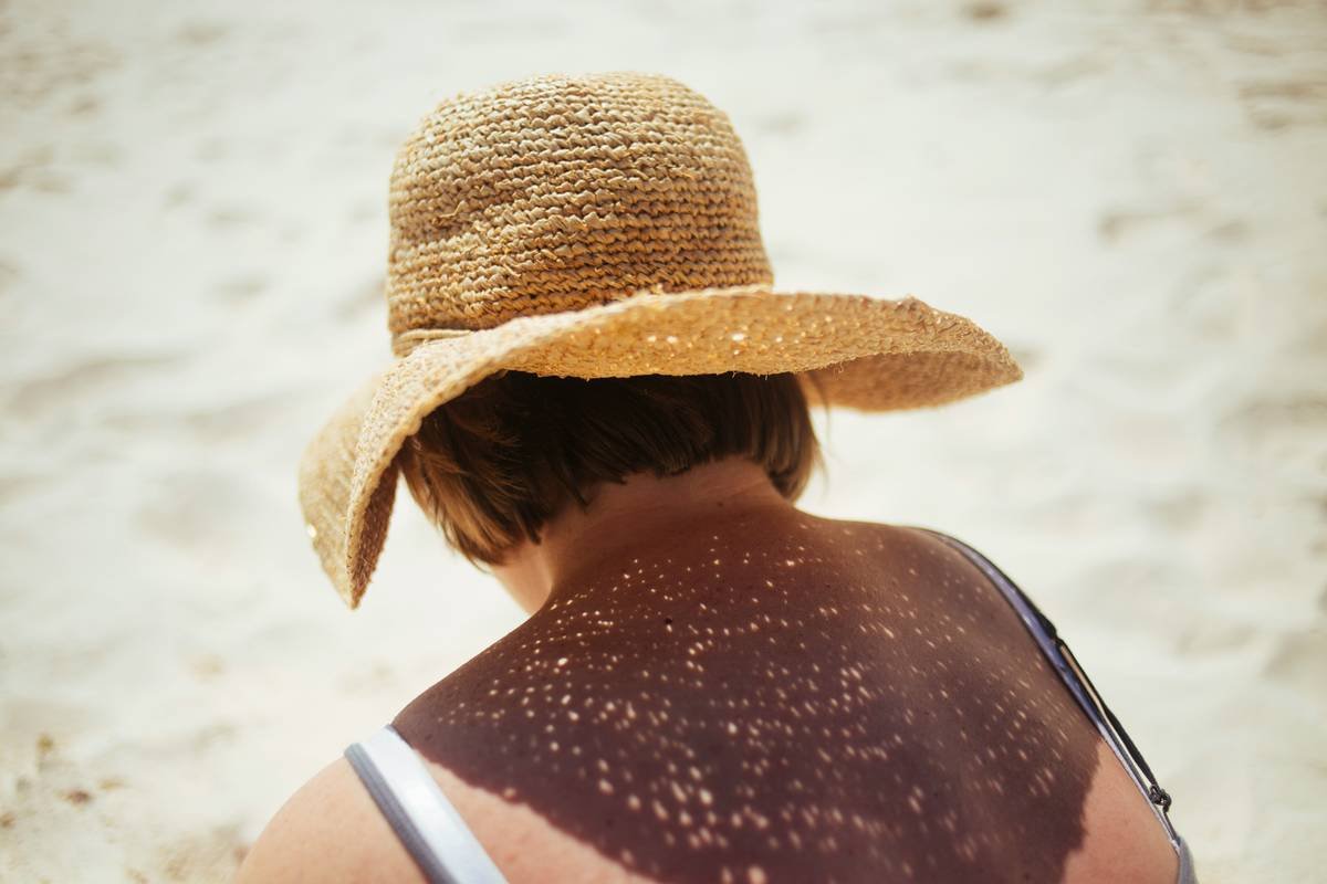 Why Your Hair Needs a Sunblock Hair Treatment (And How to Actually Use One)